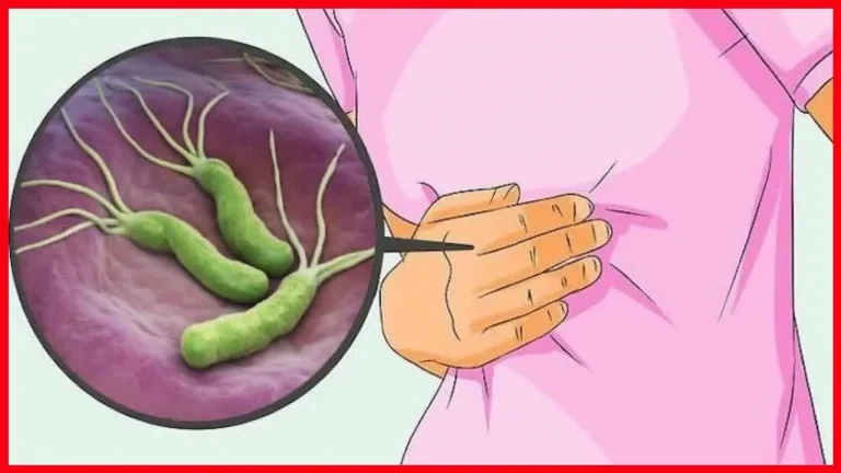 Helikobakter pilori Enfeksiyonu