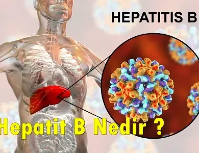 Hepatit b