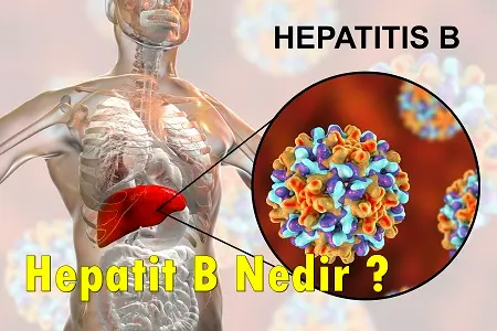 Hepatit b