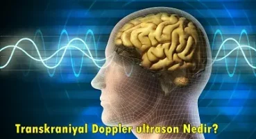 Transkraniyal Doppler Ultrason Nedir