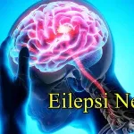 epilepsi hastalığı nedir