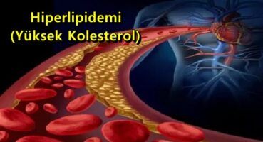 Hiperlipidemi (Yüksek Kolesterol)