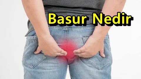 basur nedir