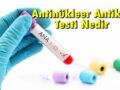 Antinükleer Antikor Testi
