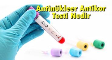 Antinükleer Antikor Testi Nedir?