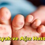 El ayak ve ağız hastalığı nedir