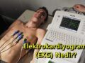 Elektrokardiyogram EKG
