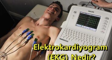 Elektrokardiyogram EKG Nedir?