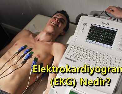 Elektrokardiyogram EKG