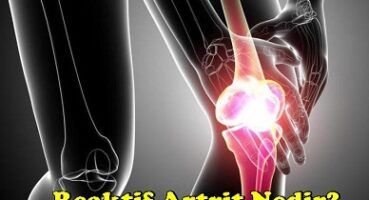Reaktif artrit nedir