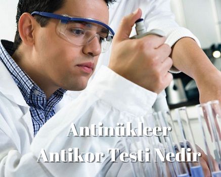 Antinükleer Antikor Testi