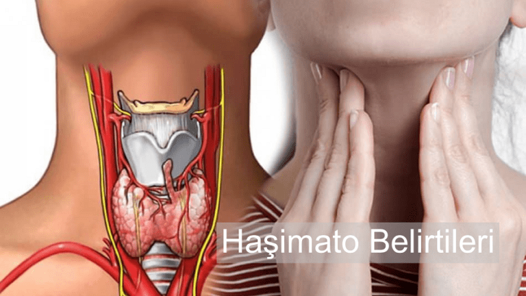 Haşimato Belirtileri