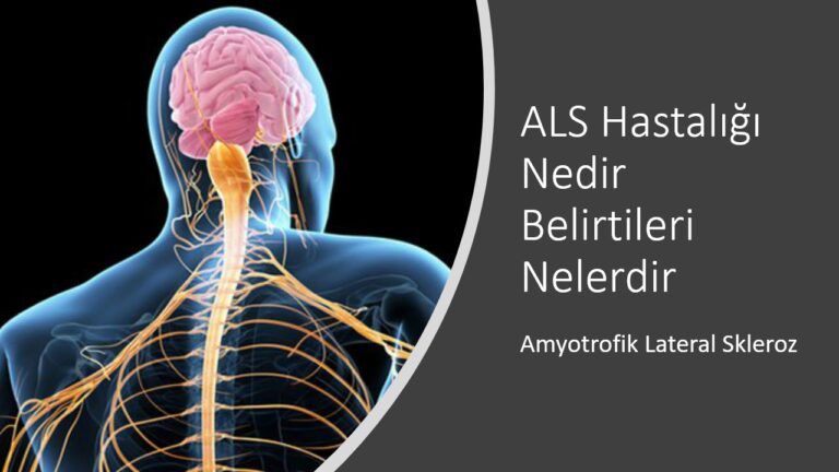 ALS Hastalığı Nedir Belirtileri Nelerdir
