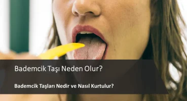 Bademcik Taşı Neden Olur?