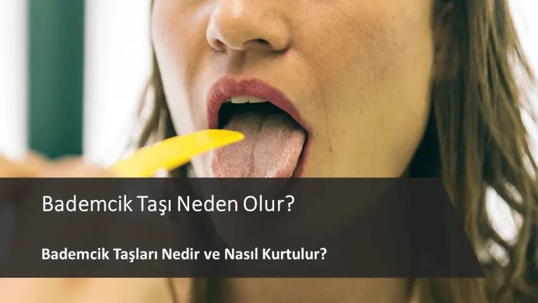 bademcik taşı neden olur