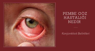 Konjonktivit Nedir (Pempe Göz Hastalığı)