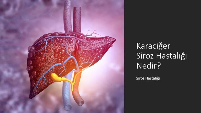 Karaciğer Siroz Hastalığı Nedir