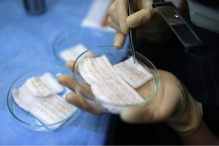 saç ekim fiyatları