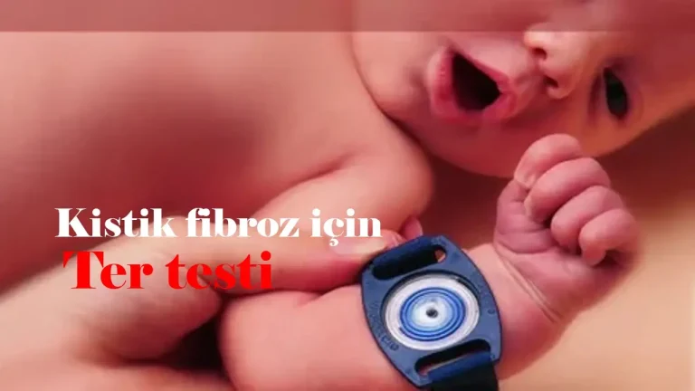 Kistik fibroz için Ter testi