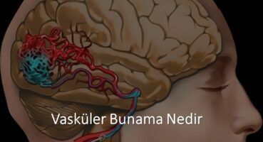 Vasküler Bunama Nedir ?