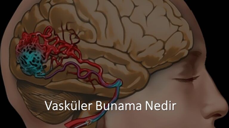 Vasküler Bunama Nedir