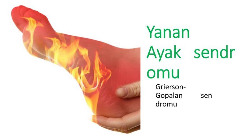 yanan ayak sendromu