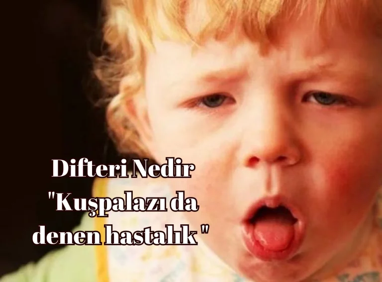 difteri nedir