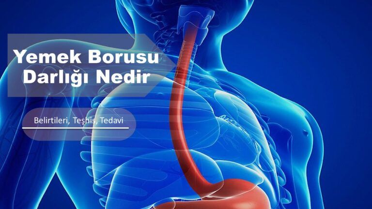 Yemek borusu darlığı