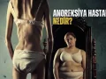 Anoreksiya hastalığı nedir