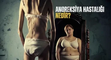 Anoreksiya Hastalığı Nedir – Anoreksiyayla İlgili Tüm Detaylar