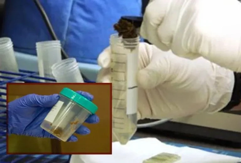 dışkıda gizli kan izi